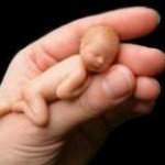Hug Ergül Gündüz - @ergulgun - Instagram