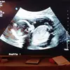 Eric Biggs - @eric.biggs3 - TikTok