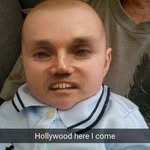 Carl-Erik Aune - @kalleknallus - Instagram