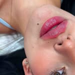 Dra. Erika Barbosa - @dra.erika.lips - Instagram