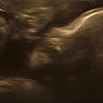 Erwin Alvarez - @erwin.alvarez.9847 - Instagram