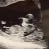 Gene - @eugene.mills69 - TikTok