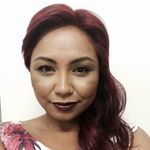Fatima Turner - @fatima_cosmeticinjector - Instagram