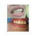 Dr/ Fatma Abdalla Dental Clinic - Facebook
