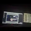 Buffington__ - @buffington__ - TikTok