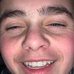Felix Berg - @felixberg_006 - Instagram