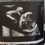 Flora Pollock - @flora.pollock72 - Instagram