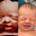 Forever Yours Ultrasound | 3D/4D Ultrasounds - @foreveryoursultrasound - Instagram