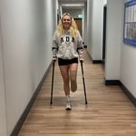 Francesca - @franberry_adaptiveamputee - Instagram