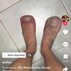 Fred burns - @fredburns69 - TikTok