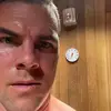 fredtravis098 - @fredtravis098 - TikTok