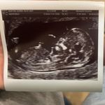 Gemma Burton - @gemma_burton.xoxo - Instagram