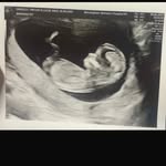 @gemma_dingley - Instagram
