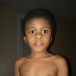 Glenn - @glennlightskin - Instagram