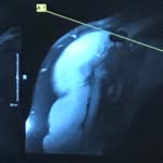 Grayson Manning - @bolder_boulder_shoulder_holder - Instagram