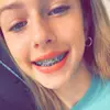brace face - @brace.face.hailey__ - TikTok