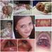 Hailey Schutte Fundraiser - Facebook