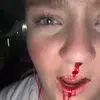Hanna Jensen - @hannajensen_1 - TikTok