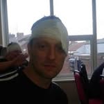 Iain Davies - @blinkey1966 - Instagram