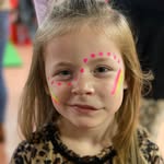 Iris Howard - @iris_lymphatic_malformation - Instagram