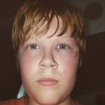Isaac Barney - @deathmeloncolony - Instagram
