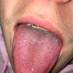 Jack Sickler - @snack.dickler - Instagram