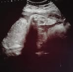 Jacob Abercrombie - Facebook