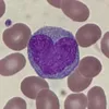 monocyte - @jacob_fleck0078 - TikTok