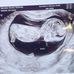 Jacob Meier - Facebook