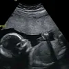 Jake_bedford - @jake_bedford0 - TikTok