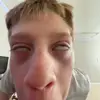 jakesilverman142 - @painhubz77 - TikTok