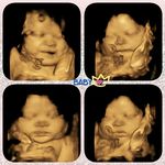 james asher abdon - @jamesasherabdon - Instagram