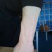 James Doyle's arms - Facebook