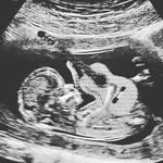 James Button - @jammb78 - Instagram