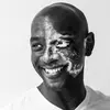 James McLeod - @thatvitiligo_guy - TikTok