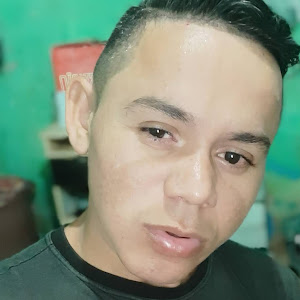 severo james - @severojames1 - TikTok