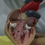 Penyakit Jantung Anak Bawaan - @jantunganak - Instagram