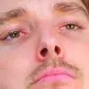 jennifernutbrown - @lazarbeam_fan3 - TikTok
