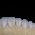 Jhon Ruiz - @jhonruizlaboratoriodental - Instagram