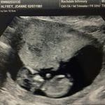 Joanne Alfrey - @alfreyjoanne - Instagram