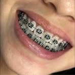 Jane Braces - Facebook