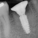 Dr Guibert Jocelyn ,9 rue bis abel Hovelacque - @jg_dental13 - Instagram