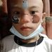 John Derick Ablao - Facebook