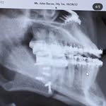 John Bacon - @_bacon8or_ - Instagram