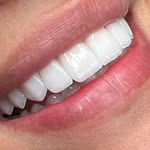 John Cali Colombia 🇨🇴 - @john_foreversmiledentalgroup - Instagram