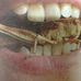 John Joyce Dental Laboratory - Facebook