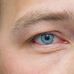 John Pacey-Lowrie Ltd. Artificial Eye Clinic - Facebook