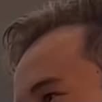 @john_viras_receding_hairline - Instagram