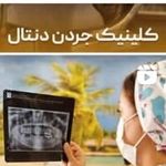 🦷کلینیک دندان پزشکی جردن دنتال 🦷 - @jordandentalclinic - Instagram