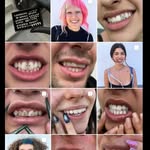 elnombretelodevo - @joyeria.dental.shoa.saucedo - Instagram